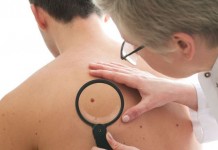 Prevenzione dei tumori della pelle, visite gratuite: ecco le date