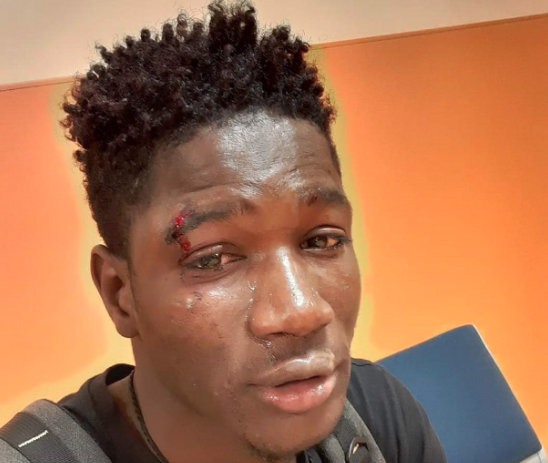 aggressione - senegal