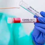 Coronavirus-dati-al-26-agosto-1367-nuovi-positivi-e-oltre-93.000-tamponi-in-piu_articleimage